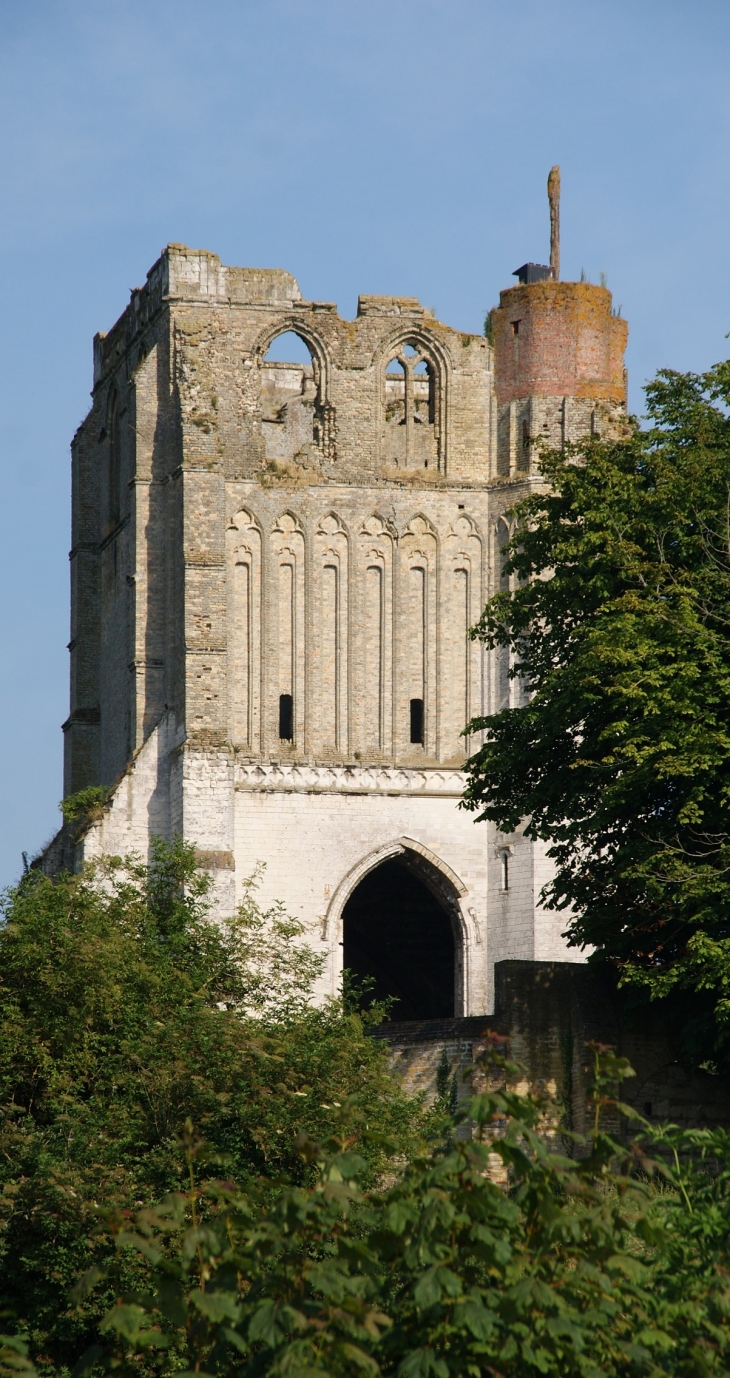 Tour de l'Ancienne Abbaye  - Watten